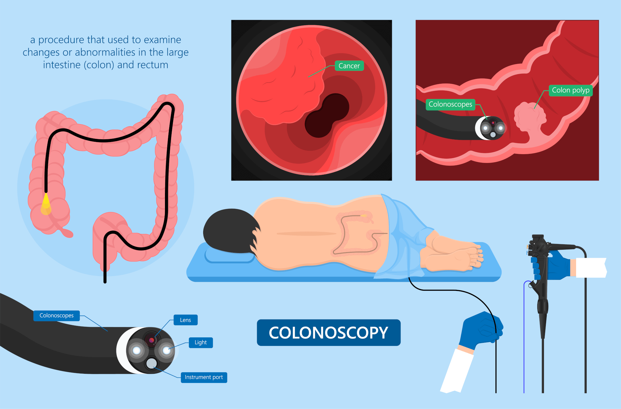 Endoscopy Why you should STOP avoiding scheduling your Colorectal